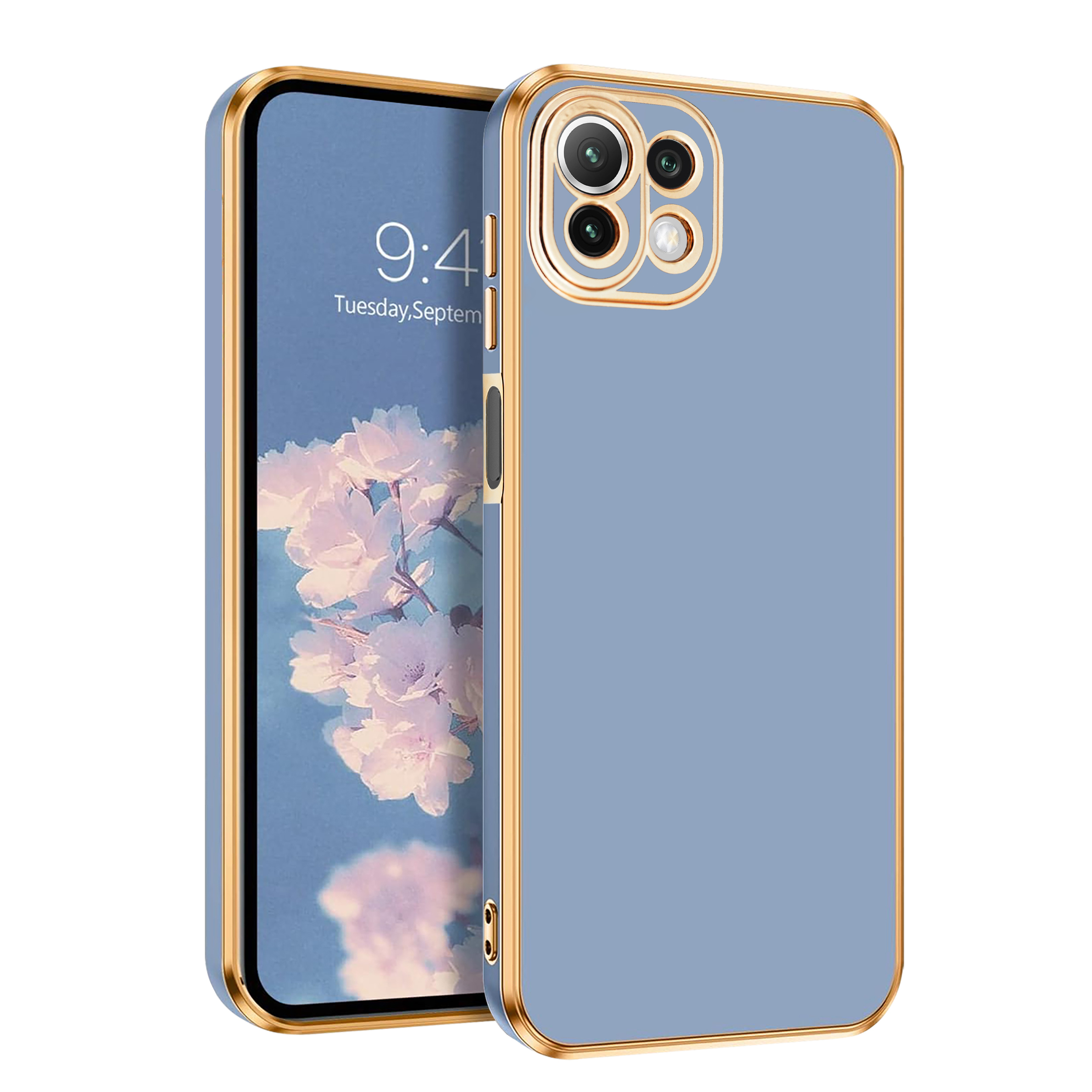 کاور موکولو مدل Xuka مناسب برای گوشی موبایل شیائومی Mi 11 Lite 4G / Mi 11 Lite 5G / 11 Lite 5G NE - Image 2